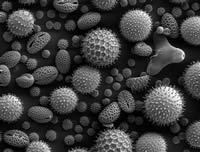 花粉の電子顕微鏡写真